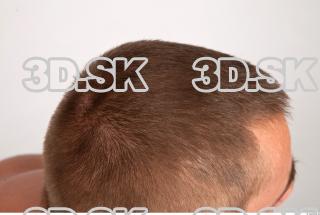 Hair texture of Gene 0003